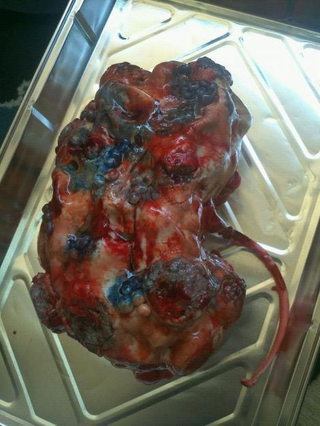 Illustration for article titled STD cupcakes could cure the worst sugar craving